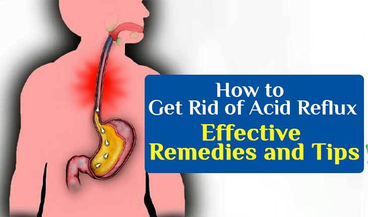 How to Get Rid of Acid Reflux: Effective Remedies and Tips